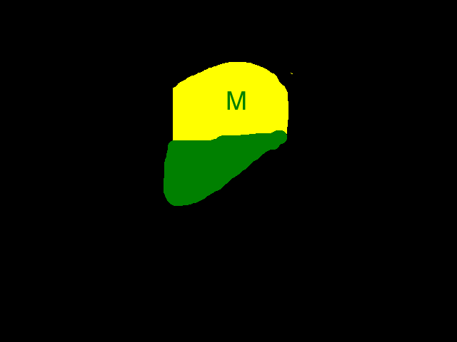 Mendenhals hat.png